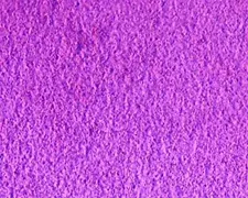 Time-lapse microscopy of living bacteria